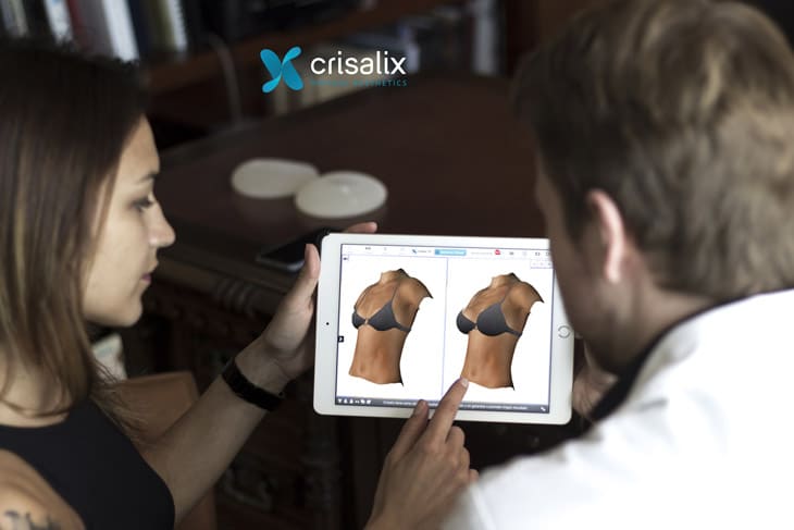 crisalix-3d-simulation-brust