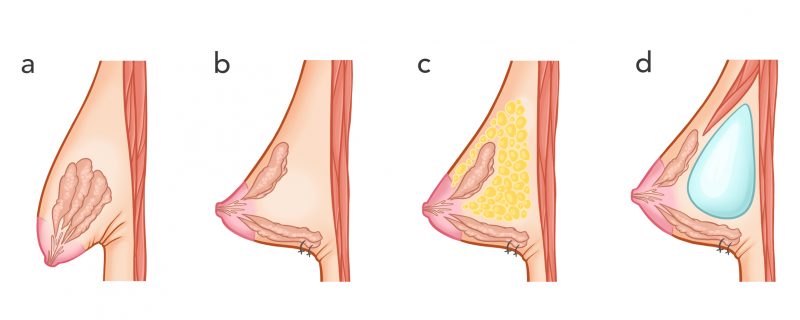 A brustgröße Average breast