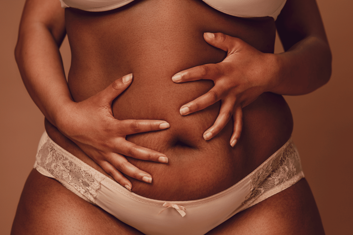 Bauchstraffung nach Schwangerschaft oder Gewichtsverlust