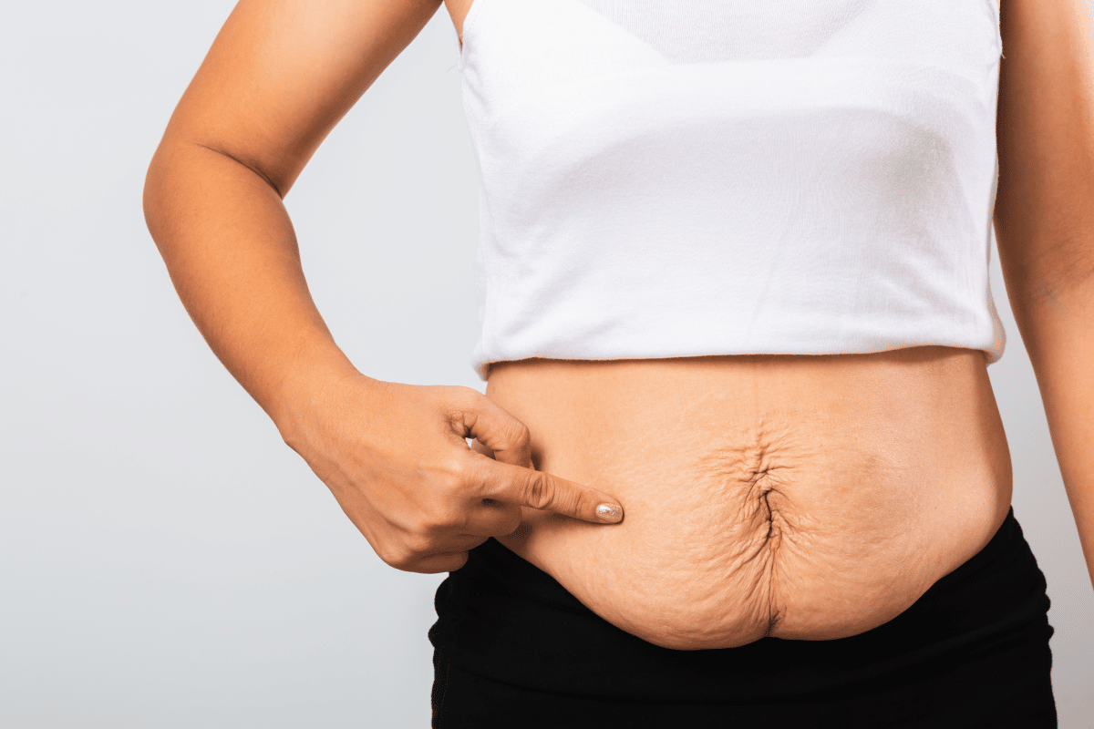 Körper nach der Schwangerschaft: Mama Bauch