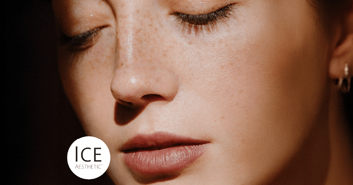 ICE Aesthetic Cristal Skin Radiofrequenztherapie in Berlin erleben